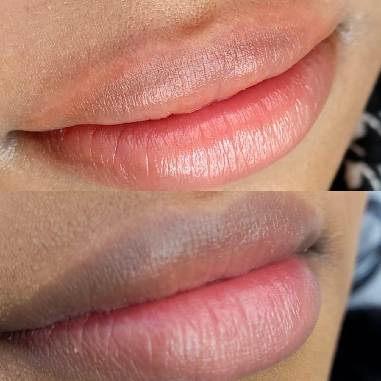 Materiais e protocolo para procedimentos de estética facial no Tatuapé