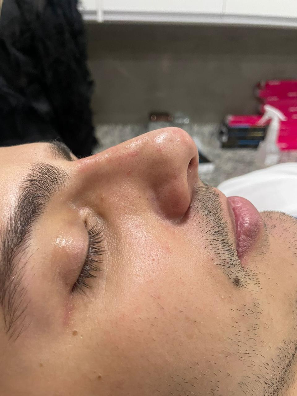 Atendimento em estética facial no Tatuapé